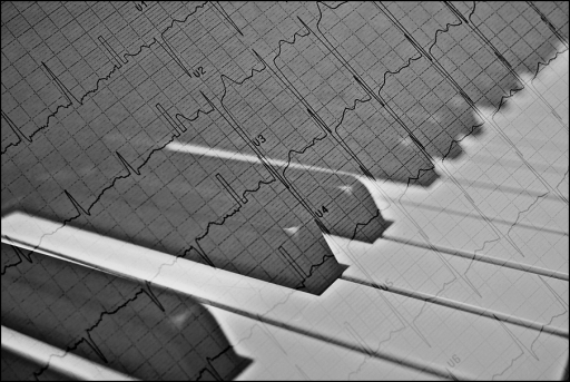 musicoterapia